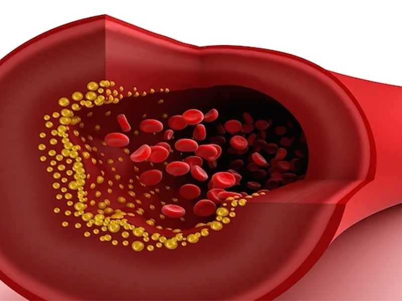 Total Kolesterol Testi